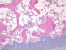 Scientific article by Dr. Haba S.Shaheed: - Bone Decalcification