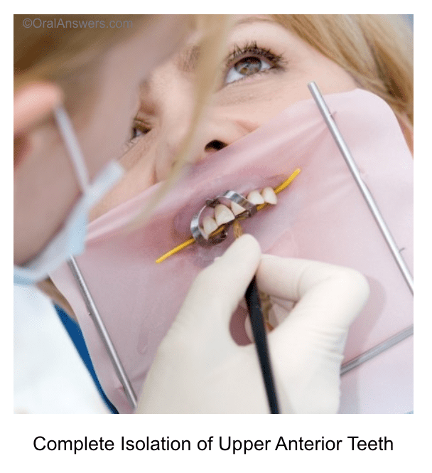 Scientific article for the head of the Department of Dentistry, Prof. Azra Yahya Muhammad Al-Hegazy, entitled “When and Why We Use Rubber Dam Isolation”