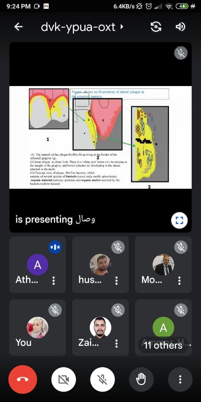 An electronic scientific symposium for Dr. Virgin Yahya Muhammad Al-Hijazi entitled (Etiology and pathogenesis of dental caries)