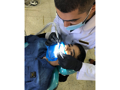 Direct anterior composite restoration
