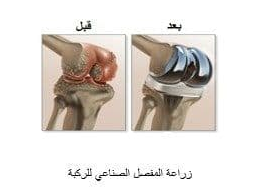  المواد الحيوية (Bio Materials)  
