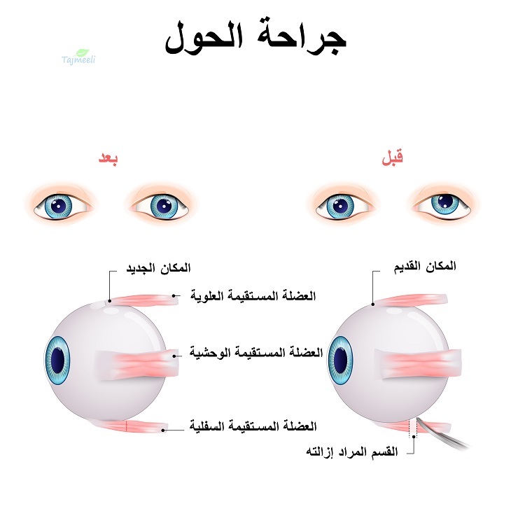 default image