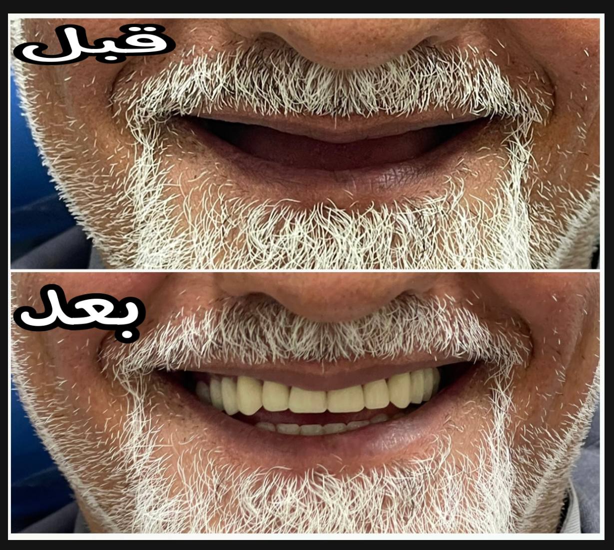 جانب من ابداع الطالبة زهراء زمان في عمل طقم لمريض 