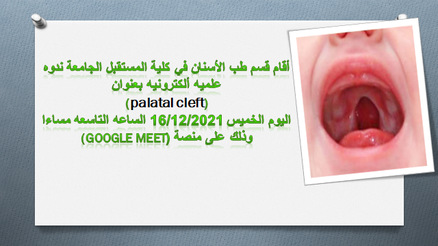 The Department of Dentistry holds an electronic scientific symposium entitled (palatal cleft)
