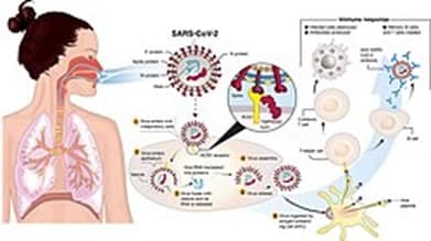 COVID-19 And The Risk Of Pulmonary Venous Thromboembolism/م.د علي رضا