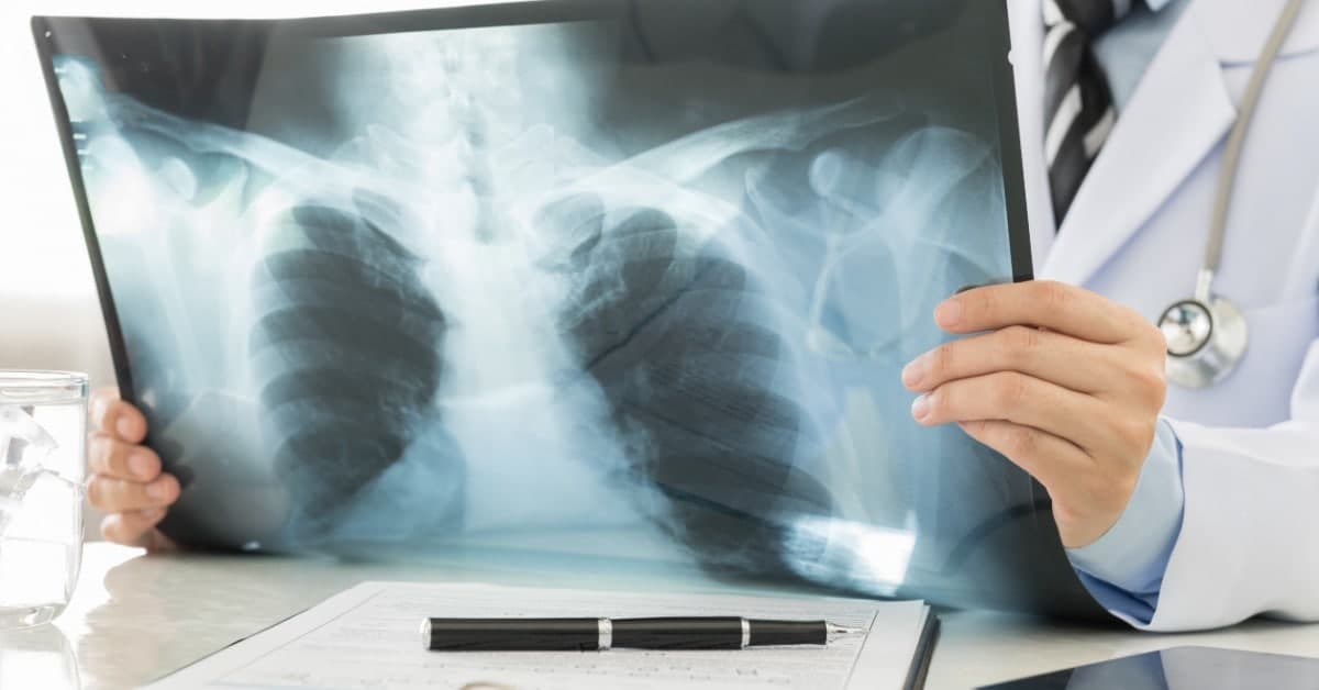  م.د محمد جوادWhat is an x-ray?