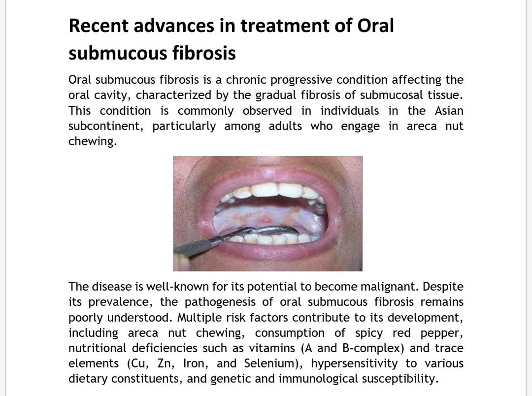 Recent advances in treatment of Oral submucous fibrosis