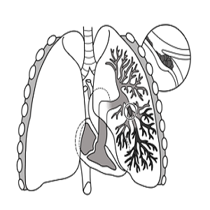 default image