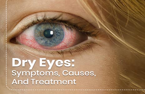 مقالة علمية للدكتوره لينوفر علي حمود بعنوان (Dry eye)