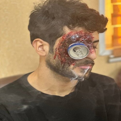 default image