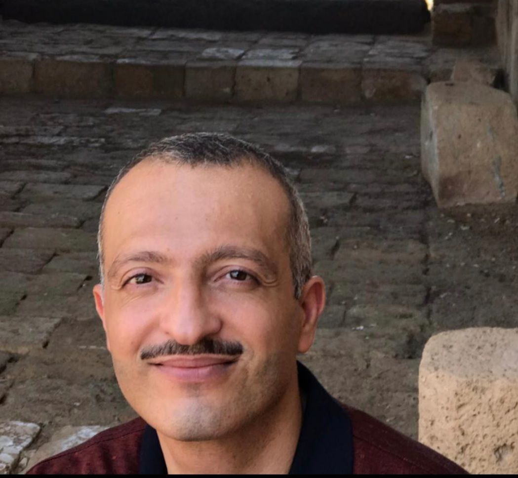 تساقط الشعر مقالة بقلم د. ميثم احمد عبدالائمه