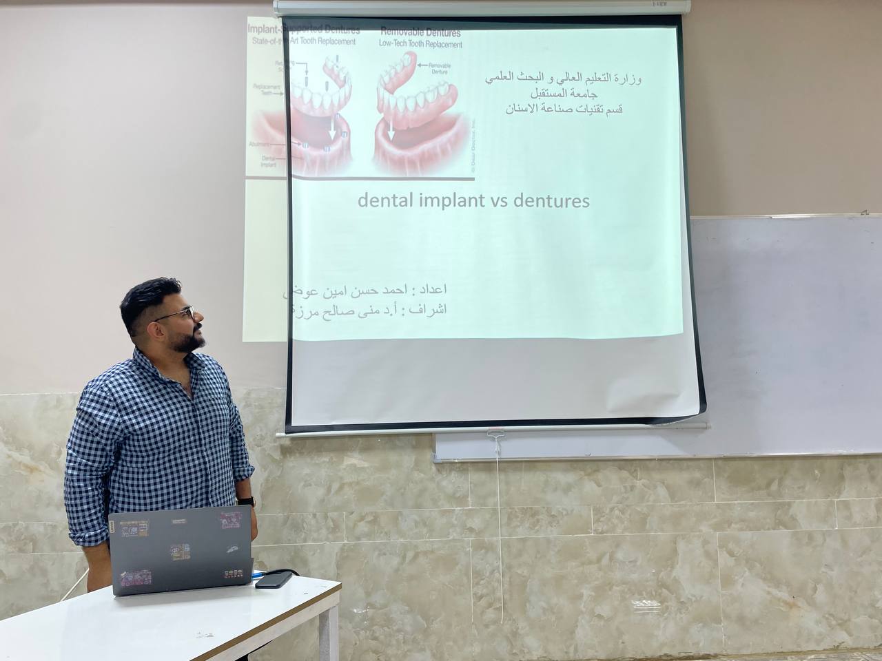Dental implants versus dentures