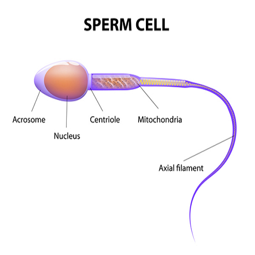 Globozoospermia