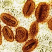 Optical biosensor rapidly detects monkeypox virus