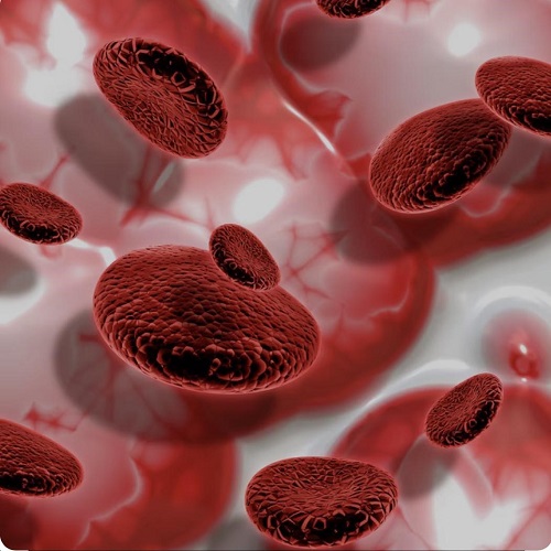             Thrombocytopenia