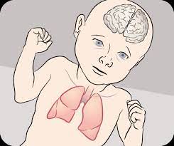 Effects of Smoking during Pregnancy