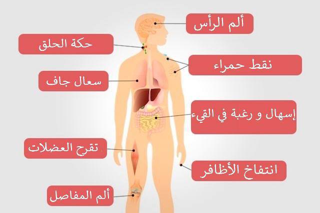 مقالة علمية بعنوان مرض الايدز واعراضه والوقاية منه للتدريسية نور حسن هادي 