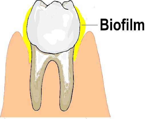 Bacterial Biofilms: