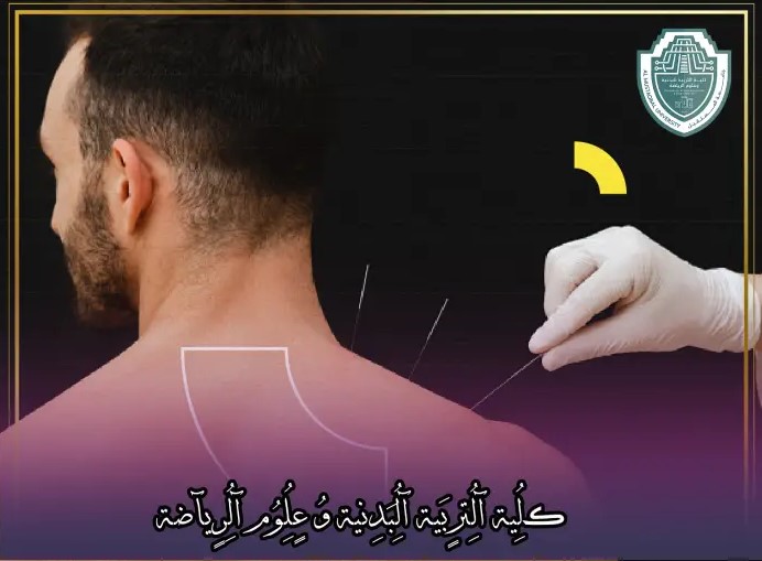 مقالة علمية بعنوان "الوخز بالإبر الصينية لعلاج الإصابات الرياضية: نهج تقليدي فعال في الطب الحديث"للتدريسي في كلية التربية الرياضية  (م.م الحسن علي خالد)