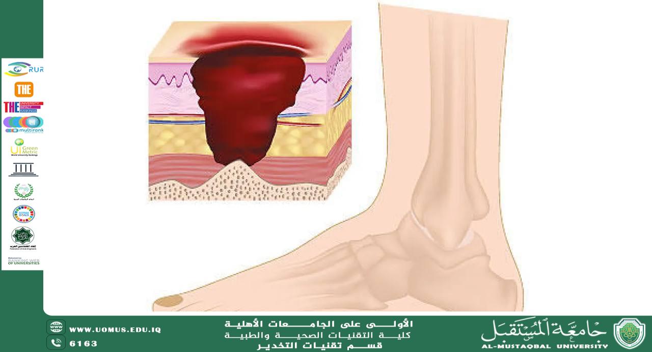 مقالة علمية للدكتور طالب جيجان حول الاعتلال العصبي السكري 