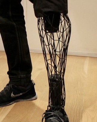 "Additive Manufacturing: The Future of Customized and Innovative Prosthetics"