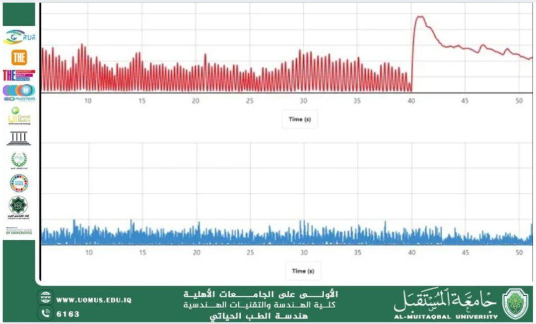 مقالة علمية بعنوان " Surface Electromyography (sEMG)" للمهندسة ضحى حسين حمزة 