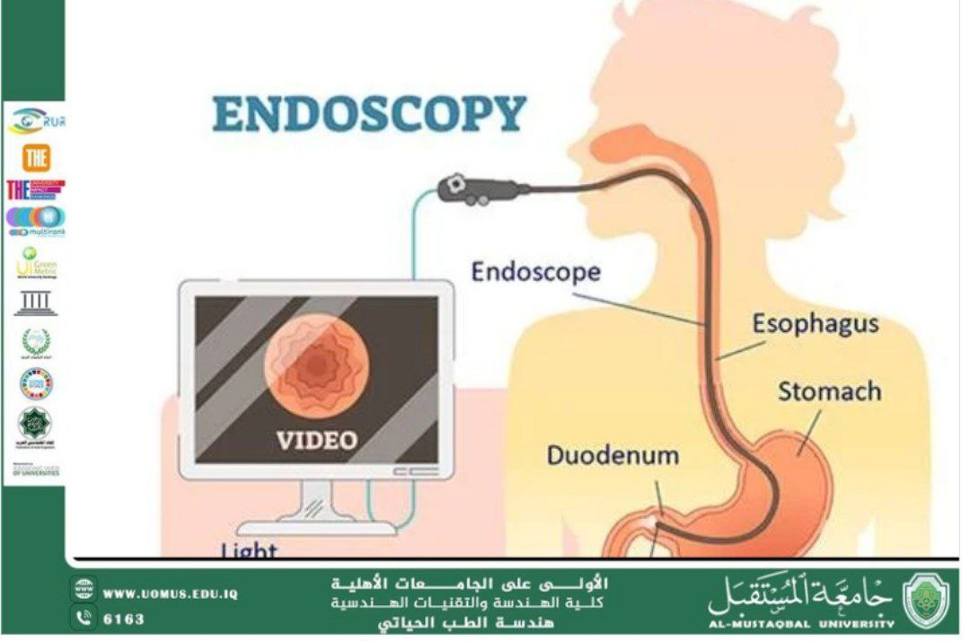 مقالة علمية بعنوان " What is an endoscopy" للمهندس محمد عبد الكريم رزوقي
