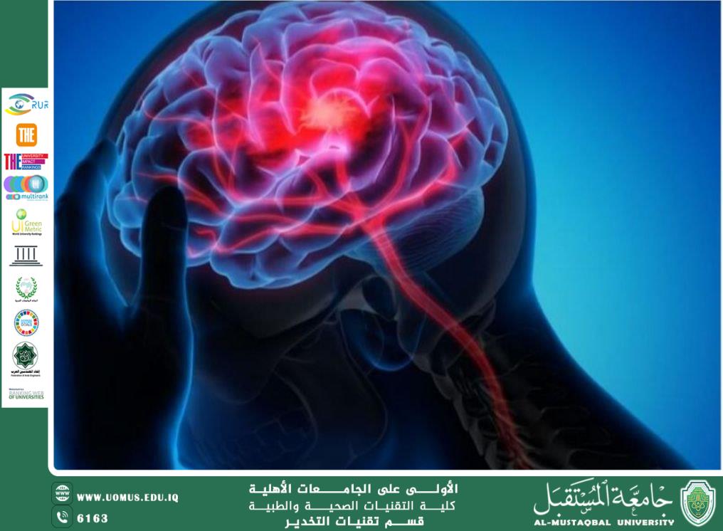 مرض الصرع