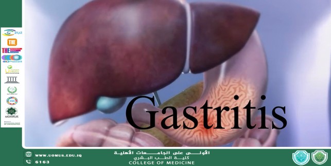 مقالة بعنوان التهاب المعدة