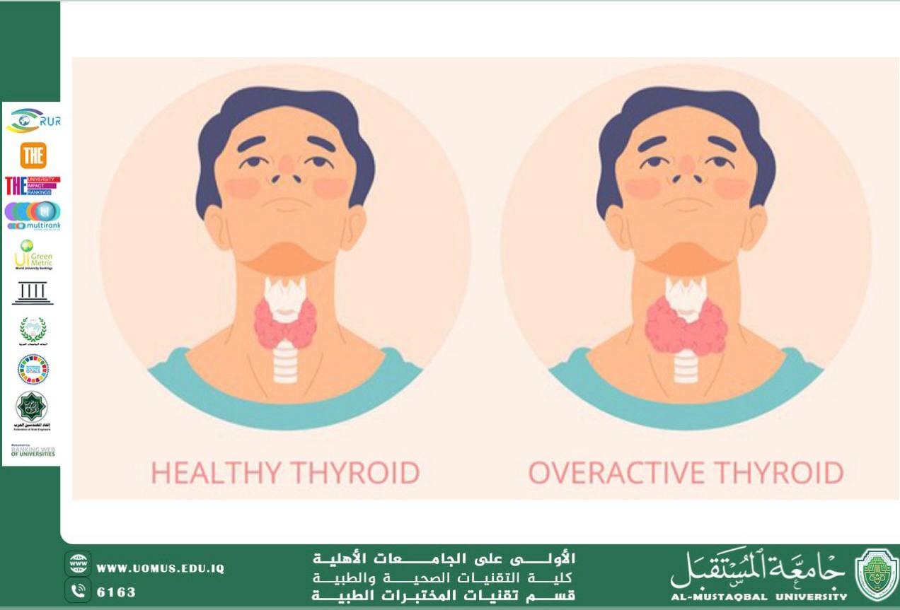 مقالة علمية للسيد امير عرفان بعنوان The Relationship between hypothyroidisim and obesity