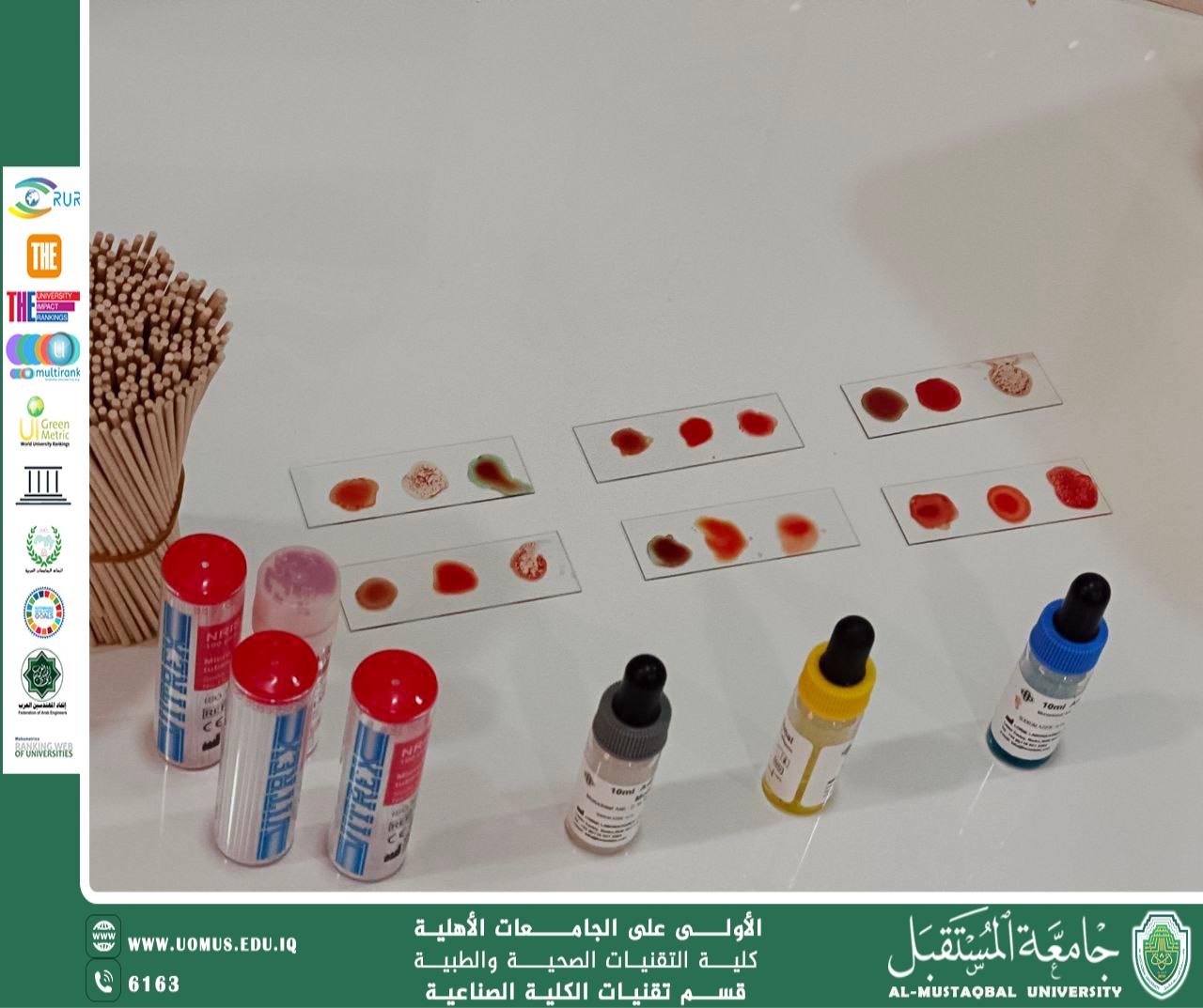 ورشة الكشف عن زمر الدم لطلبة قسم تقنيات الكلية الصناعية