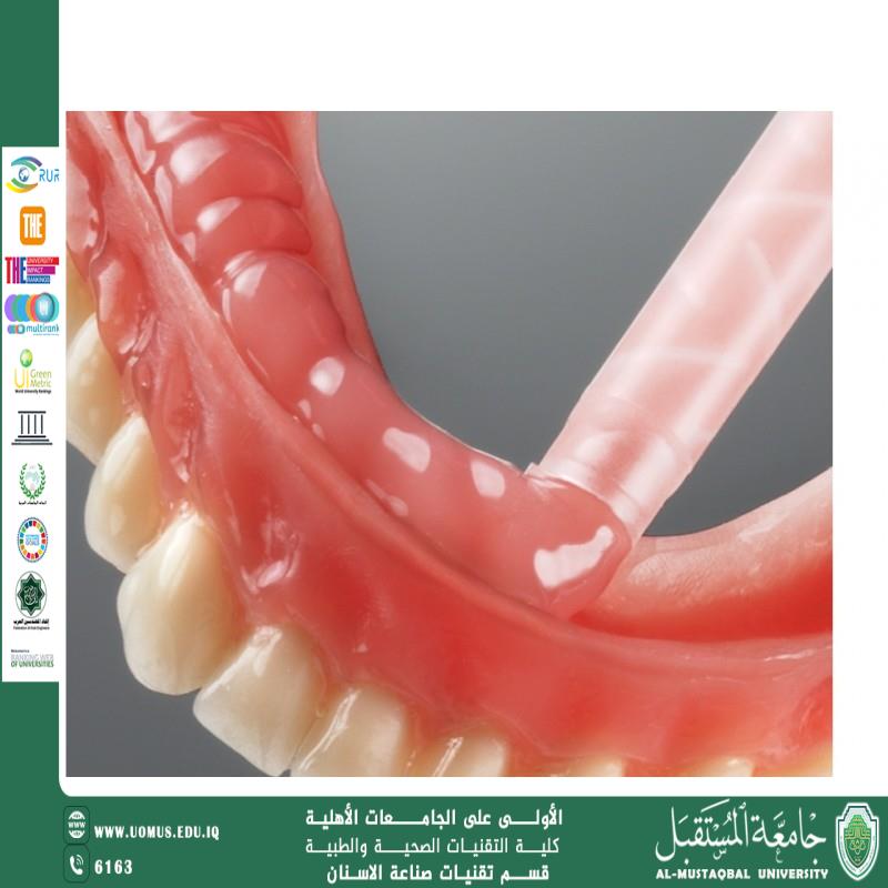 مقالة علمية لمقرر القسم ( م.م. مها حسين ديوان ) بعنوان ( Soft lining materials )
