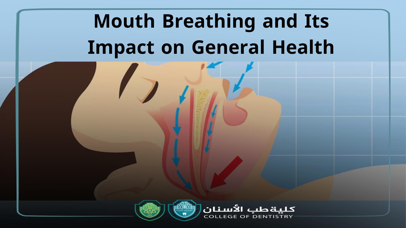 مقالة علمية جديدة للدكتور احمد ضياء بعنوان Mouth Breathing and Its Impact on General Health