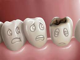 مقالة علمية بعنوان (germ in teeth ) 