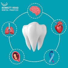 مقالة علمية للاستاذ الدكتور ( منى صالح مرزة ) بعنوان ( Gingivitis and Oral Cancer: Understanding Their Relationship and Impact on Oral Health)