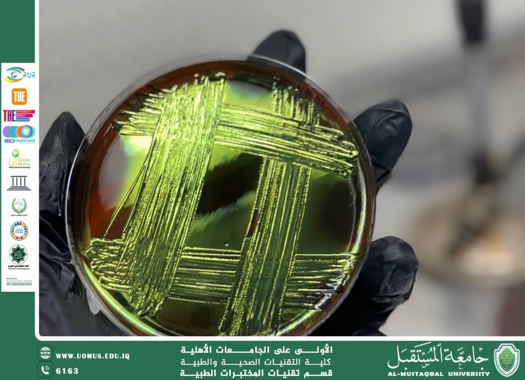 Escherichia coli (E. coli) مقالة علمية للسيدة زهراء عبيس علي بعنوان 