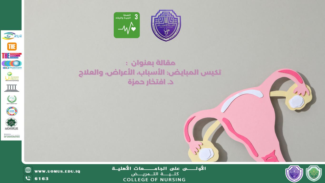 مقالة / تكيس المبايض: الأسباب، الأعراض، والعلاج