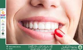 مقالة علمية للاستاذ الدكتور ( منى صالح مرزة ) (( تبييض الأسنان وحساسيتها )) 
