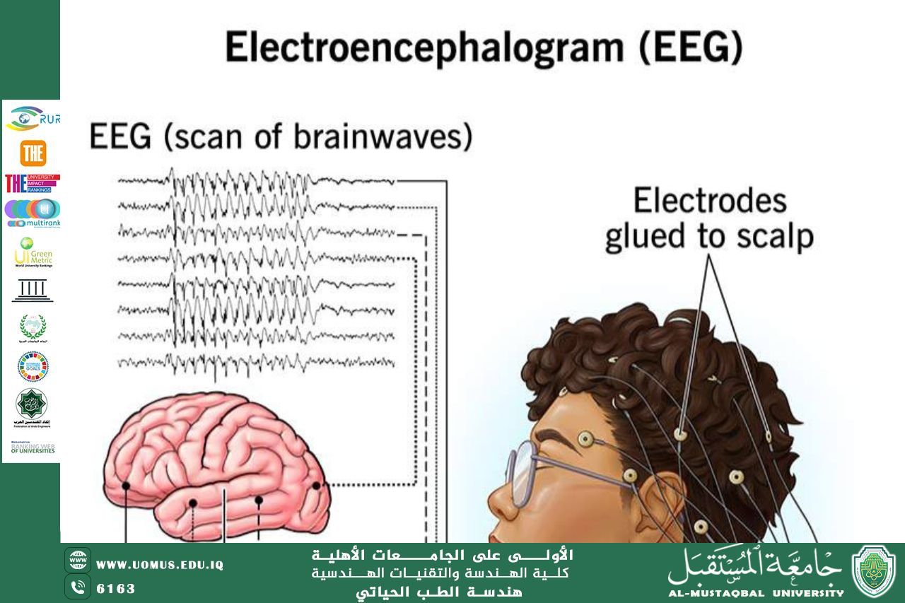 مقالة بعنوان "electroencephalogram"للمهندس محمد عبد الكريم رزوقي 