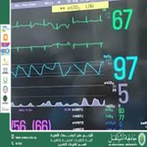Capnograph Device A Respiratory Monitoring Tool