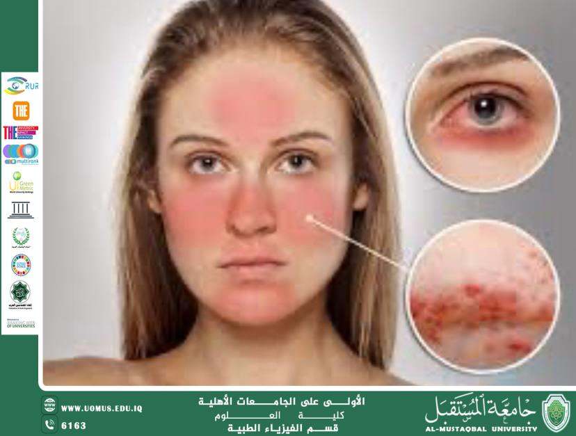 A scientific article by the teaching assistant (Iftikhar Thamer Kamel) entitled “The Effect of Sunlight on the Skin: Between Benefits and Risks”