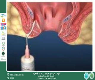 Anal Canal