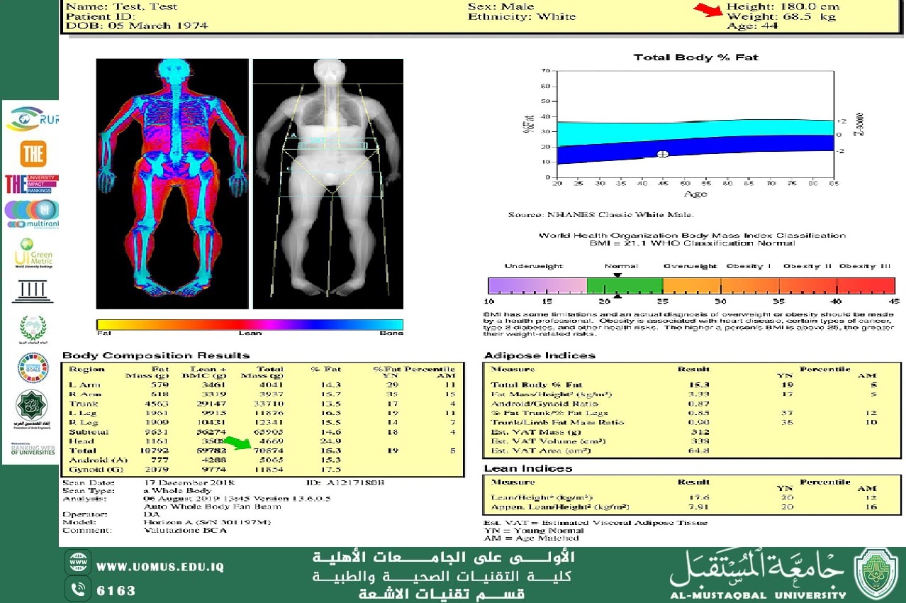Applications of Dual-Energy X-Ray Absorptiometry (DEXA) Beyond Bone Health By: Asst. Lect. Dhurgham Yousif Al-Hamdany