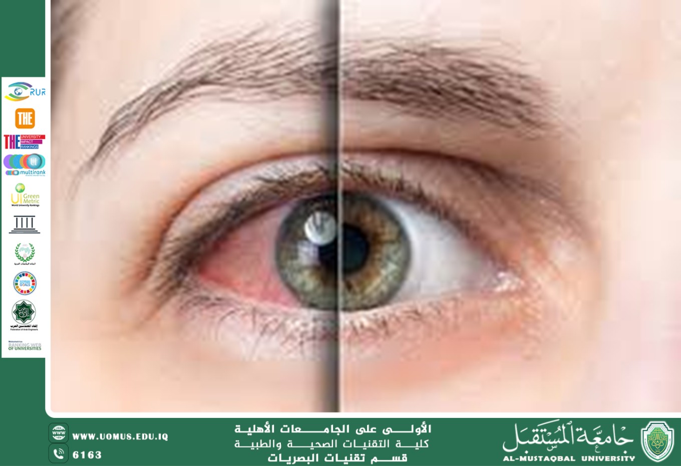 مقالة علمية للتدريسية نور خميس (صحة العين أولوية .، والسهرتهديد صامت لها).