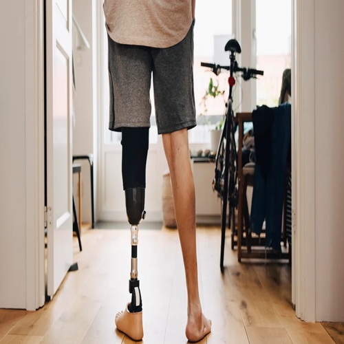The Psychological Impact of Amputation on Persons with Disabilities
