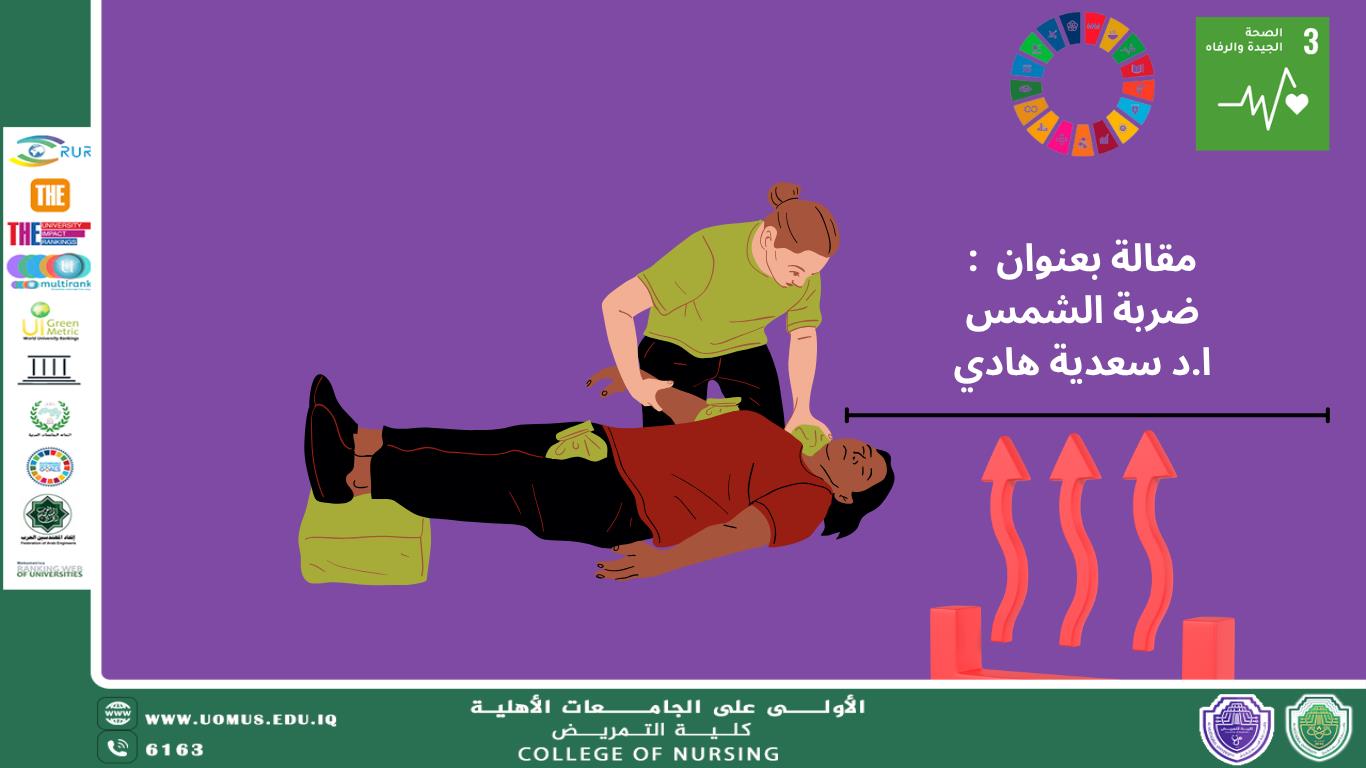 ضربة الشمس 