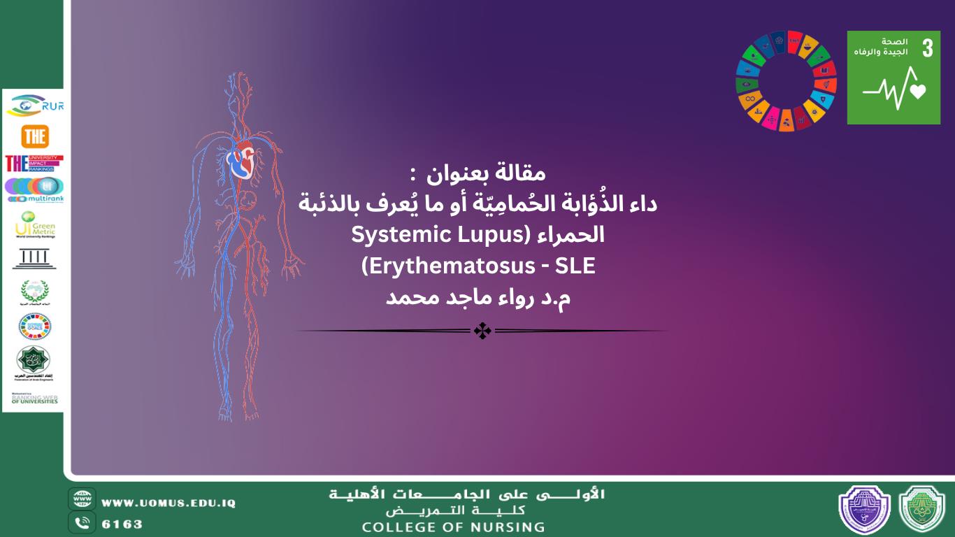 ماهو داء الذئبة الاحمراري  (Systemic Lupus Erythematosus - SLE)