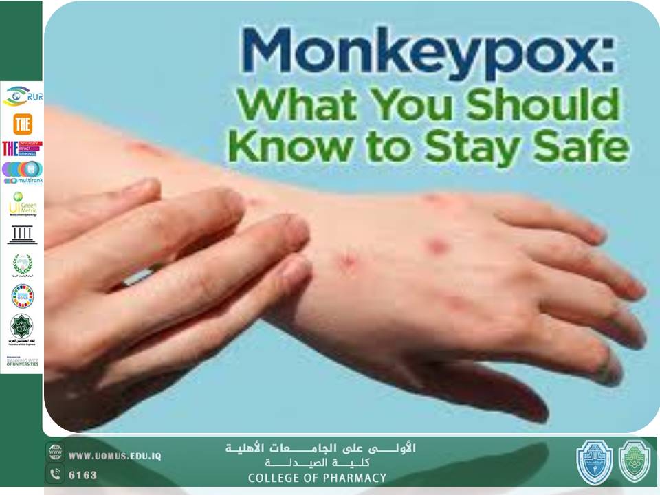 مقاله عن  مقالة عن جدري القردة  Monkeypox    بقلم ا.د.ندى خزعل في كلية الصيدلة جامعة المستقبل