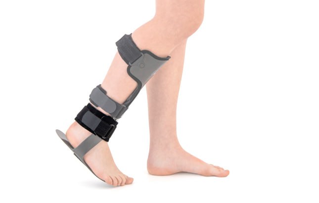 The Origin and Evolution of Orthotic Devices