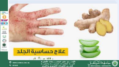 مقاله علميه بعنوان الأعشاب الطبية كبدائل طبيعية في علاج الأمراض الجلدية للست هدى رافد عبد الخالق 